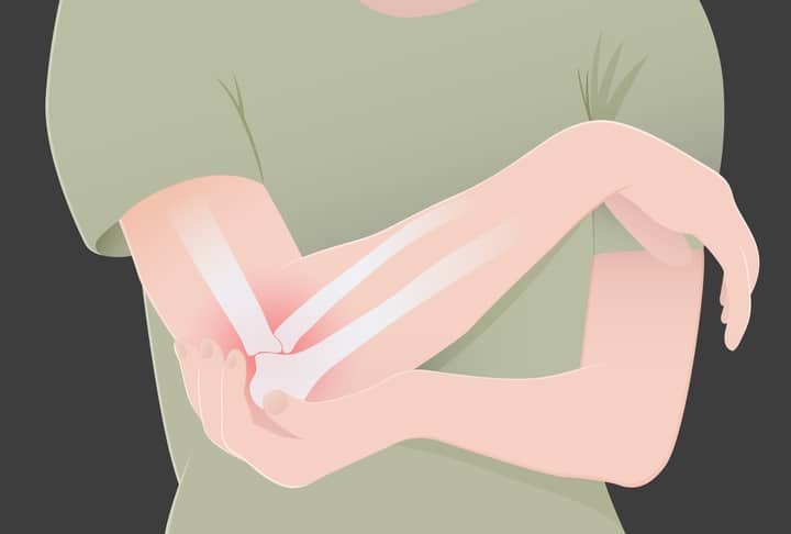 Our Nailsea Clinic Discusses Arthritis